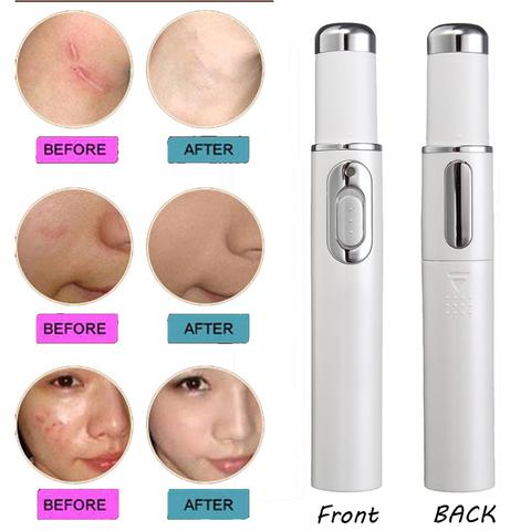 Wrinkle Blemish Pore Acne Scar Remover Pen