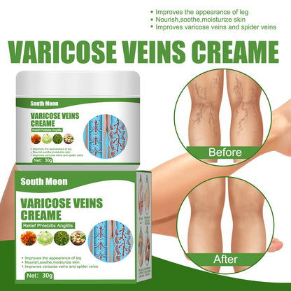 Blue Veins Bulging Pain Relief Leg Massage Cream