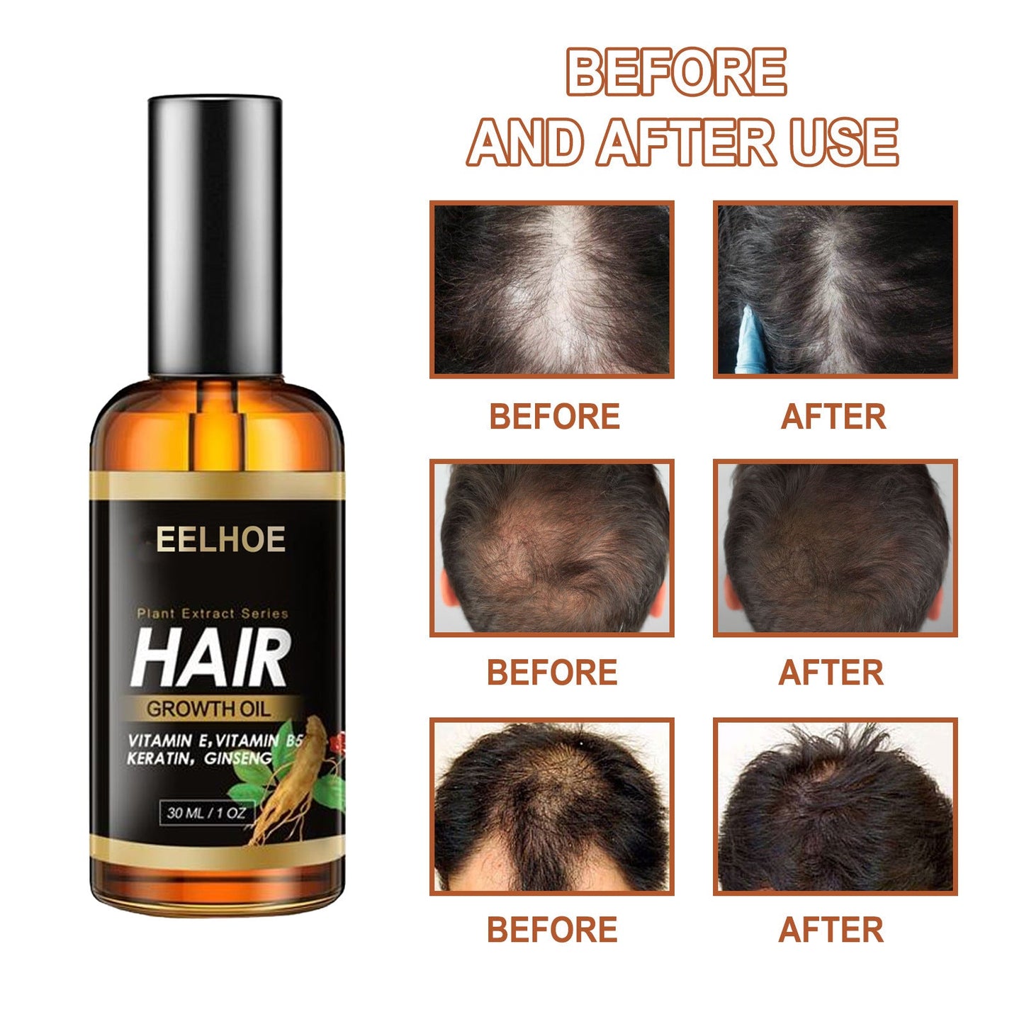 Aceite esencial EELHOE de hierbas para el cabello, aceite esencial para el cuidado capilar, fortalece el cabello, reduce la caída, el quiebre y cuida el cabello.