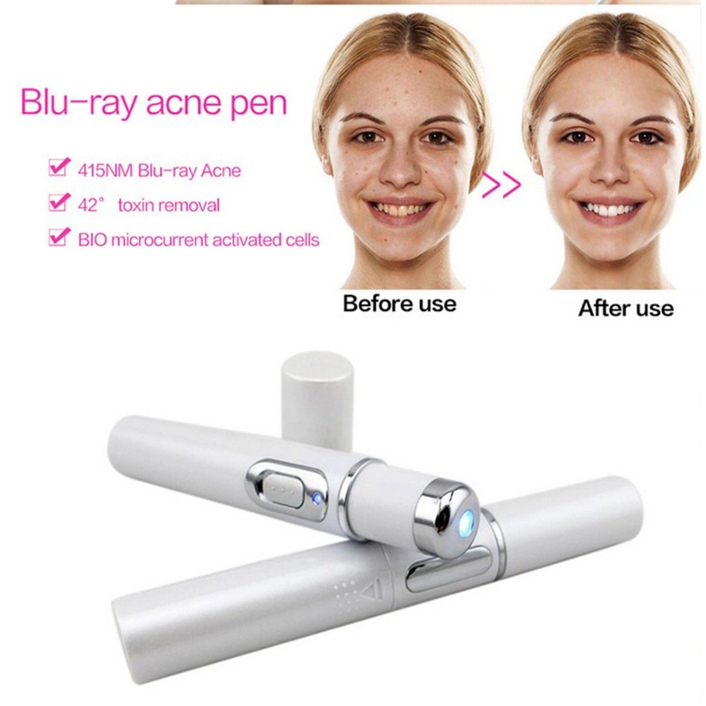 Wrinkle Blemish Pore Acne Scar Remover Pen
