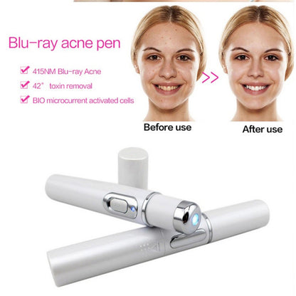 Wrinkle Blemish Pore Acne Scar Remover Pen