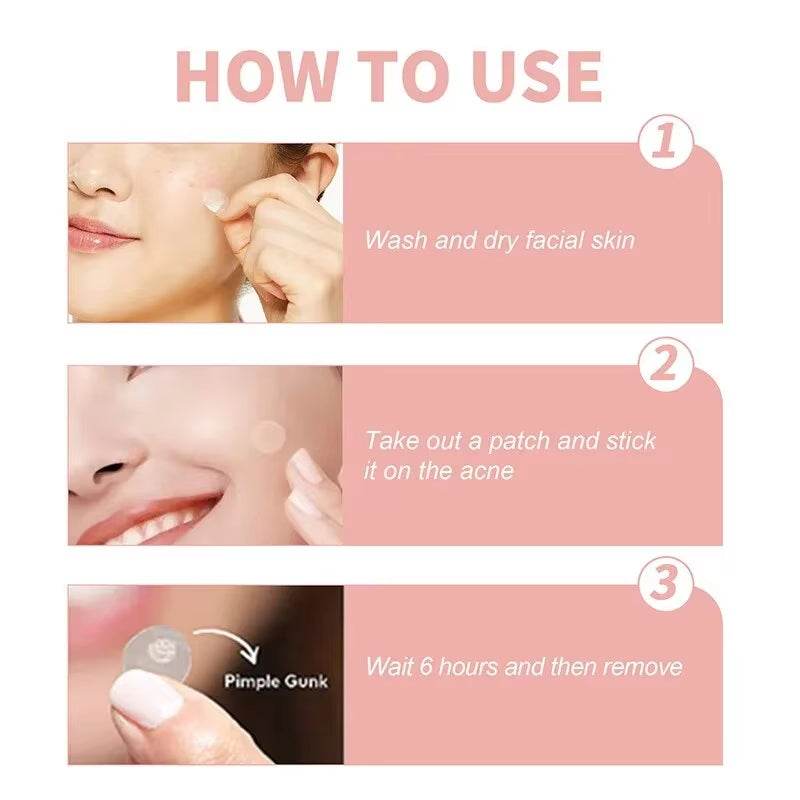 Acne Spot Healing Patches – Invisible Waterproof Stickers for Pimple Removal, Marks, and Scar Care