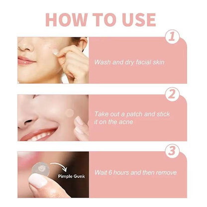 Acne Spot Healing Patches – Invisible Waterproof Stickers for Pimple Removal, Marks, and Scar Care