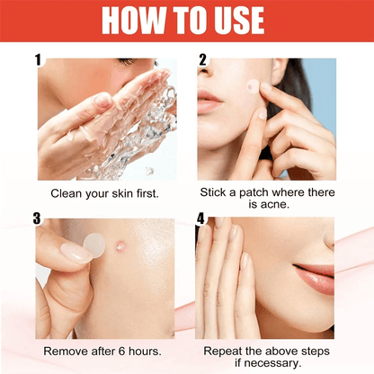 Pimple Patch Acne Dots Heart, Star, Flower & Round Shapes