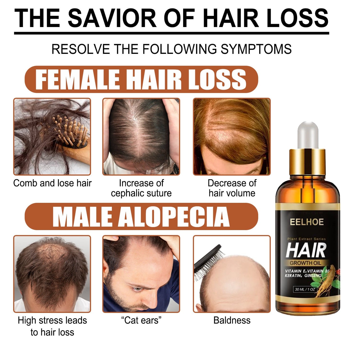 Aceite esencial EELHOE de hierbas para el cabello, aceite esencial para el cuidado capilar, fortalece el cabello, reduce la caída, el quiebre y cuida el cabello.