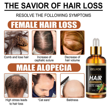 Aceite esencial EELHOE de hierbas para el cabello, aceite esencial para el cuidado capilar, fortalece el cabello, reduce la caída, el quiebre y cuida el cabello.