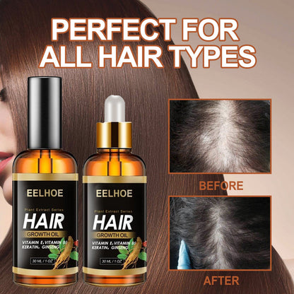 Aceite esencial EELHOE de hierbas para el cabello, aceite esencial para el cuidado capilar, fortalece el cabello, reduce la caída, el quiebre y cuida el cabello.