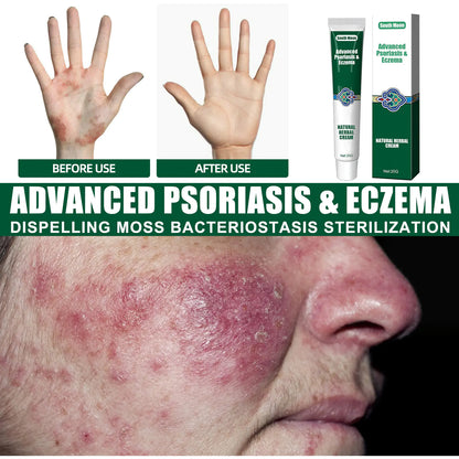 South Moon Herbal Cream for Moisturizing and Itch Relief