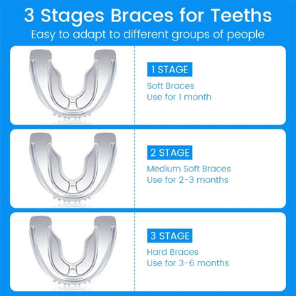 Anti Snoring Mouth Guard 3 Stages | Bruxism Teeth Grinding Sleep Aid