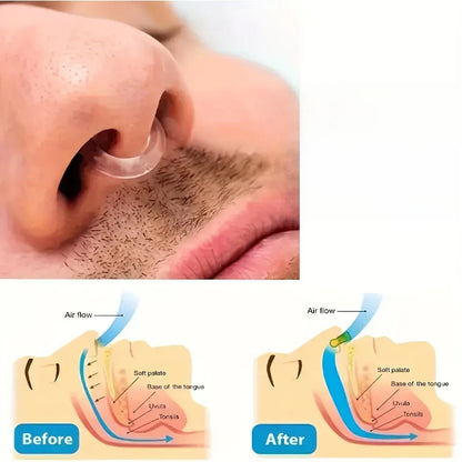 Super Soft Anti-Snoring Device | Nose Hanging Clip for Quiet Sleep