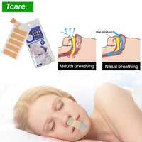 Anti-Snore Stickers 72 Pack | Nasal Strips for Snoring Relief