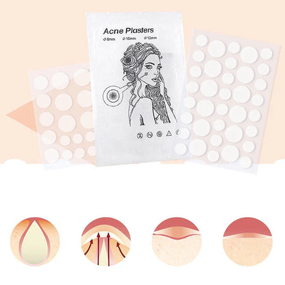 24pcs/36pcs Round Hydrogel Invisible Acne Sticker | Makeup and Skincare Tool