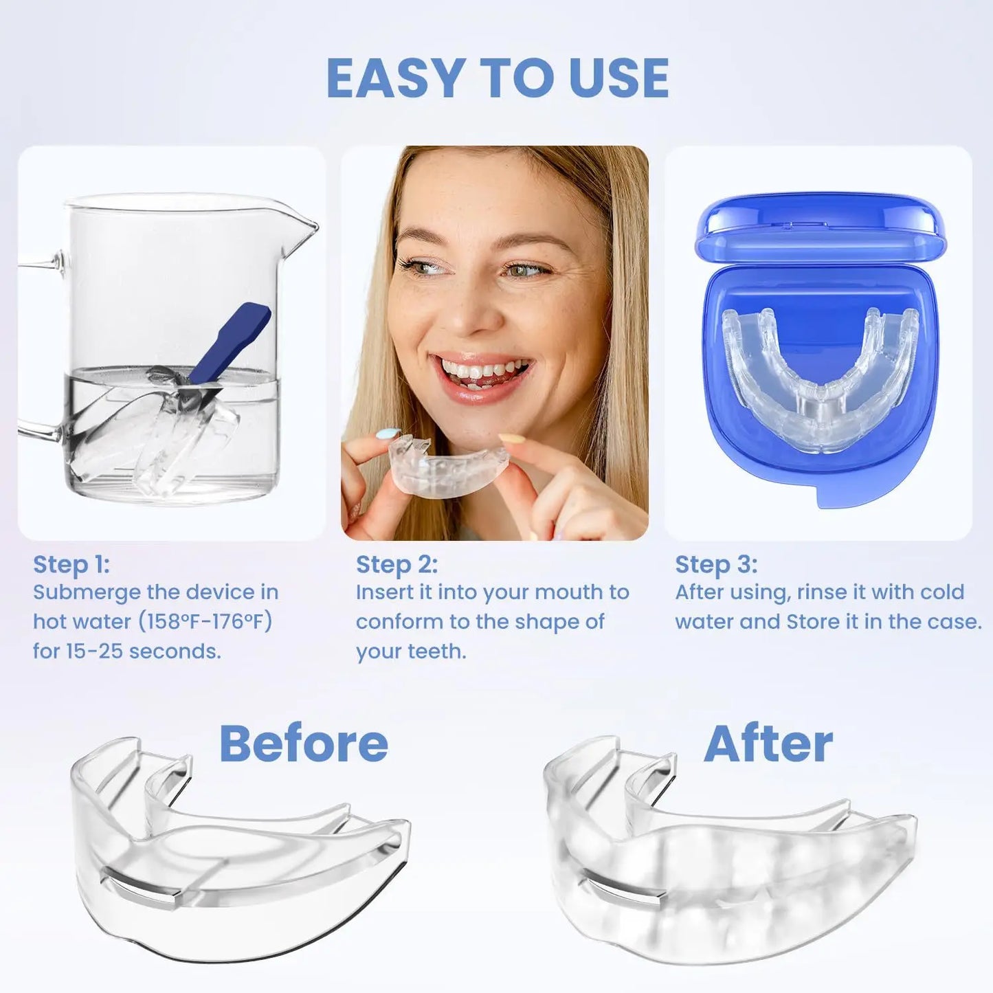 Anti Snoring Mouth Guard | Dental Night Guard for Bruxism and Sleep Aid