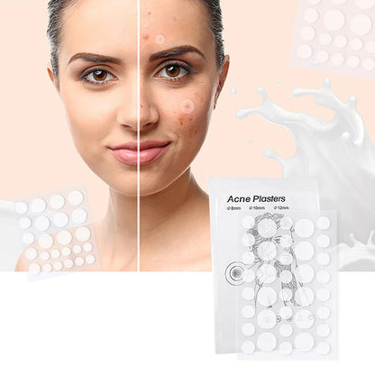 24pcs/36pcs Round Hydrogel Invisible Acne Sticker | Makeup and Skincare Tool