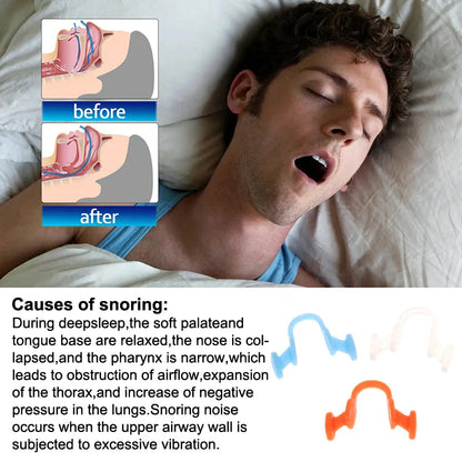 Nasal Dilator for Snoring | Stop Snoring Aid for Better Sleep