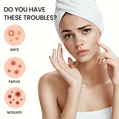Pimple Patch Acne Dots Heart, Star, Flower & Round Shapes