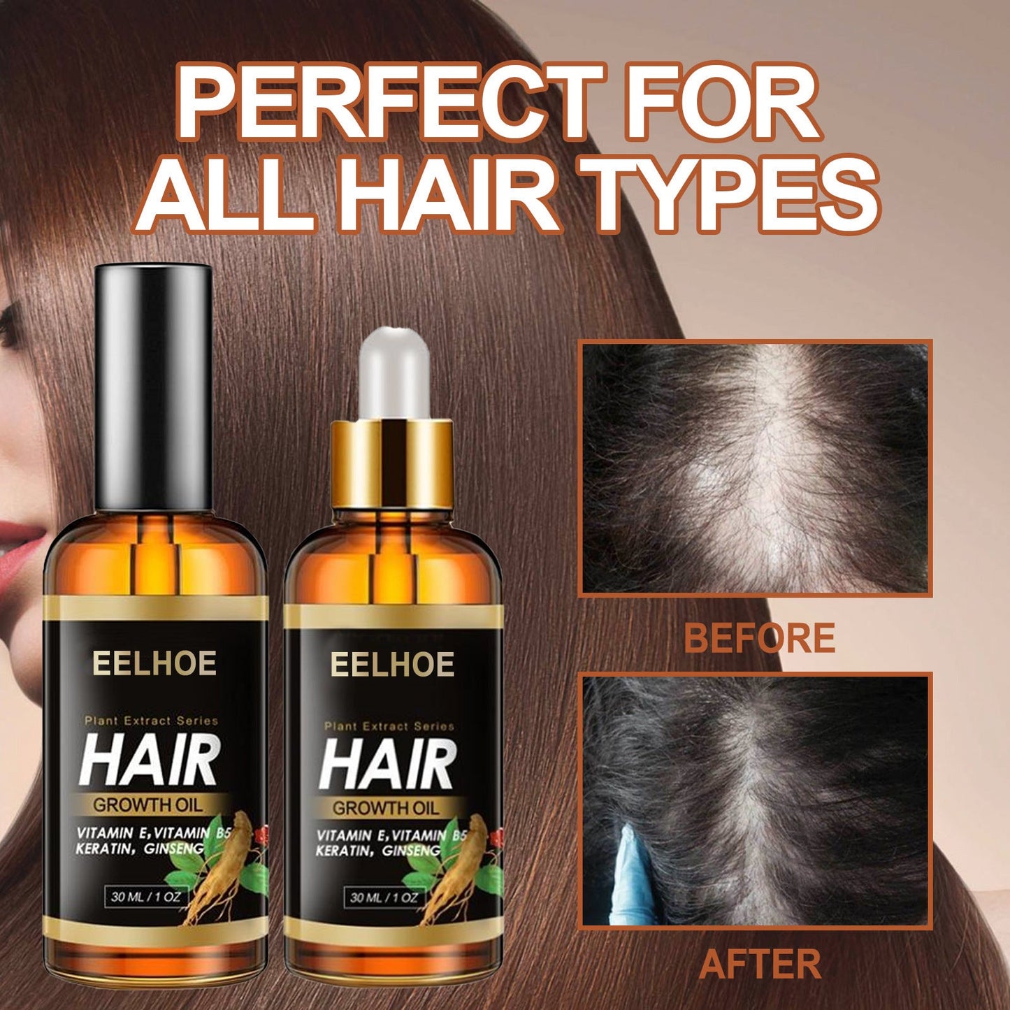 Aceite esencial EELHOE de hierbas para el cabello, aceite esencial para el cuidado capilar, fortalece el cabello, reduce la caída, el quiebre y cuida el cabello.