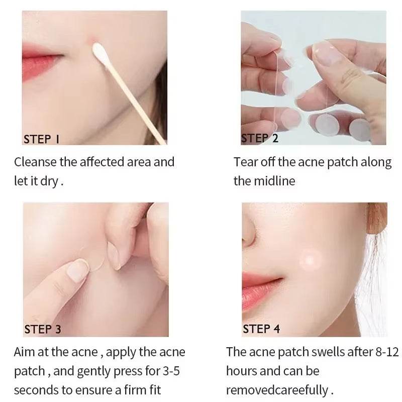 Acne Spot Healing Patches – Invisible Waterproof Stickers for Pimple Removal, Marks, and Scar Care