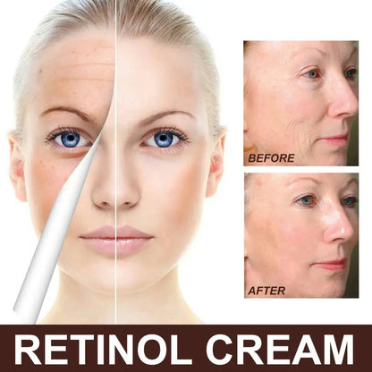 Retinol Anti Aging Skin Firming Cream