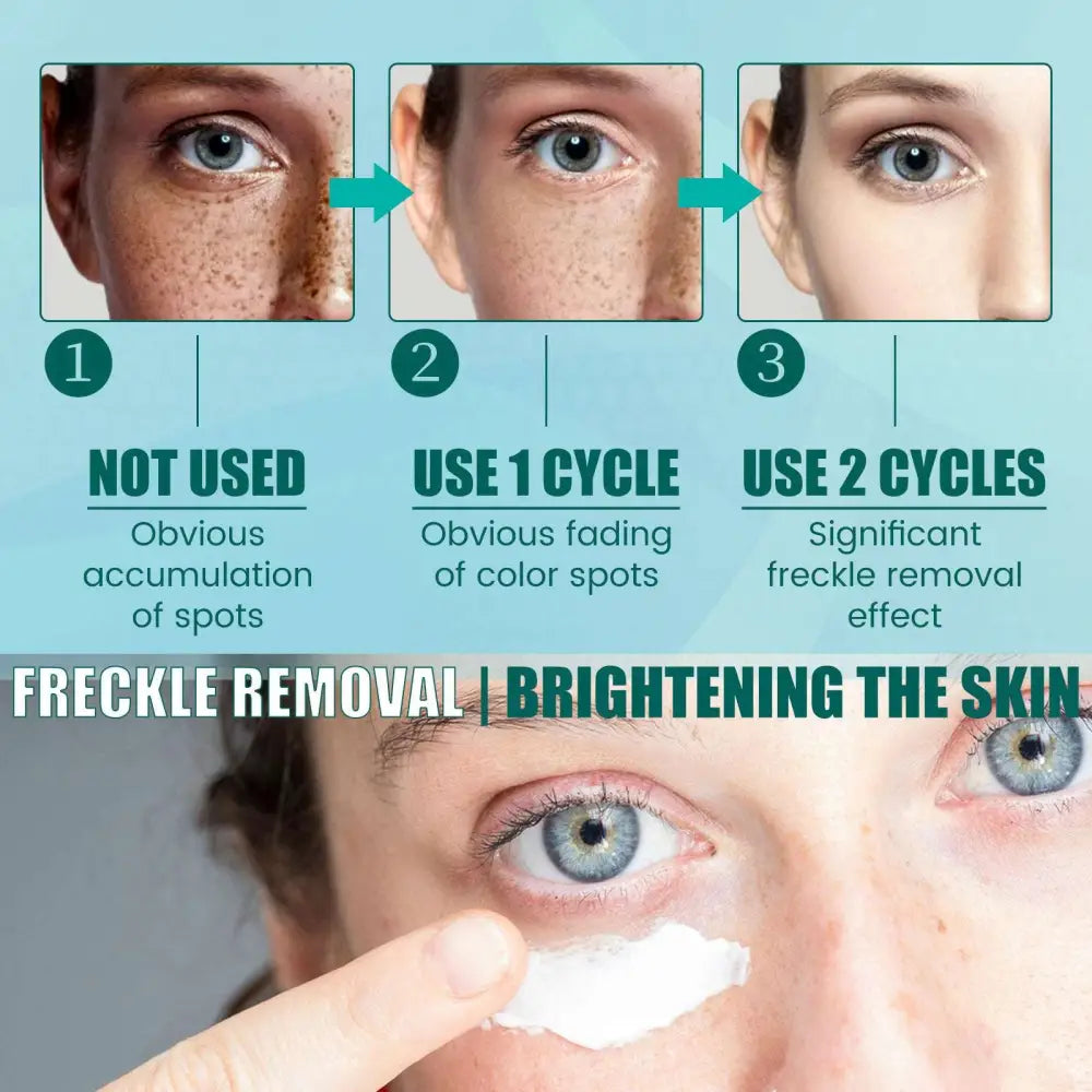 South Moon Brightening Spot Whitening Cream