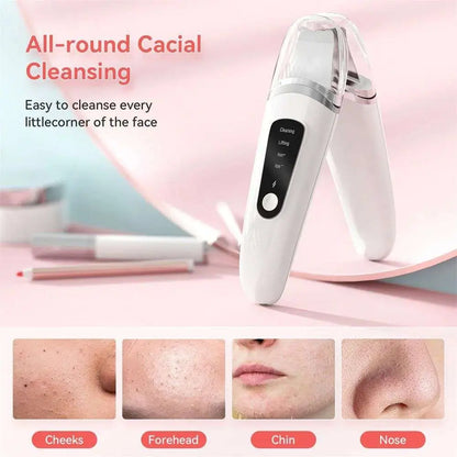 Ultrasonic Facial Skin Scrubber Deep Cleansing Tool